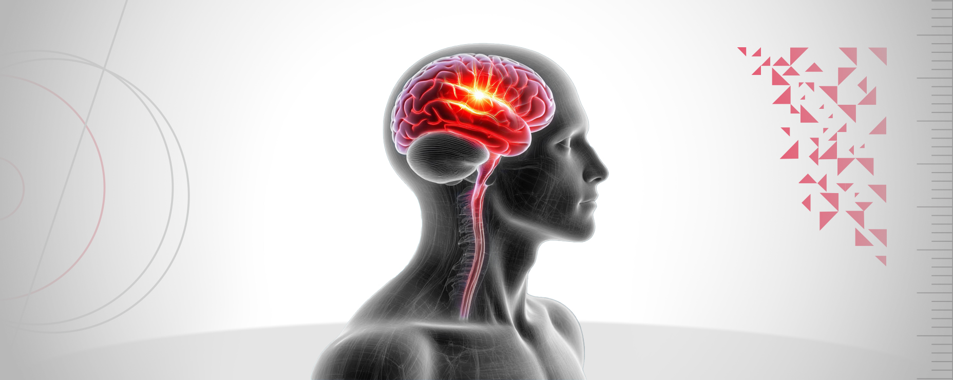 Выпуск 28: Постуральная реабилитация при прогрессирующем рассеянном склерозе