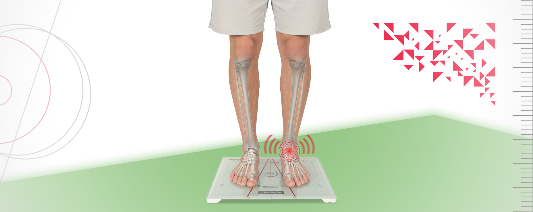 Выпуск 58: Не все направления равны: когда mSEBT действительно выявляет нестабильность голеностопа